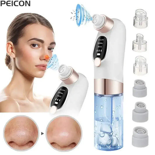 Nevytech blackhead remover vacuum provides deep pore cleansing, gentle suction, and clear skin resultsβideal for smooth, healthy-looking skin.