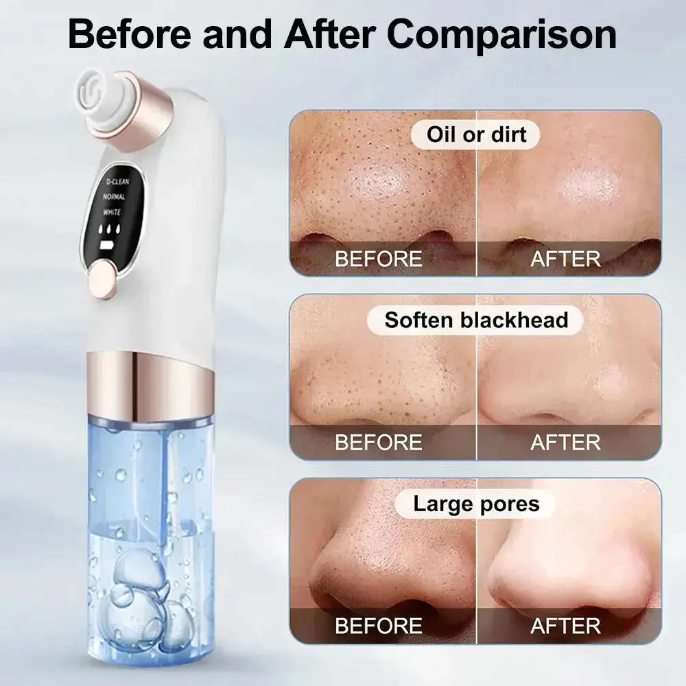 Nevytech blackhead remover vacuum provides deep pore cleansing, gentle suction, and clear skin resultsβideal for smooth, healthy-looking skin.