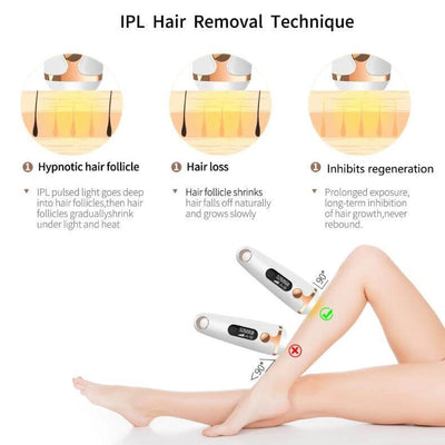 Illustration demonstrating IPL hair removal technique, showing hair follicle shrinking and inhibiting regeneration for effective hair loss.
