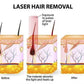 nevytech-laser-hair-removal-device