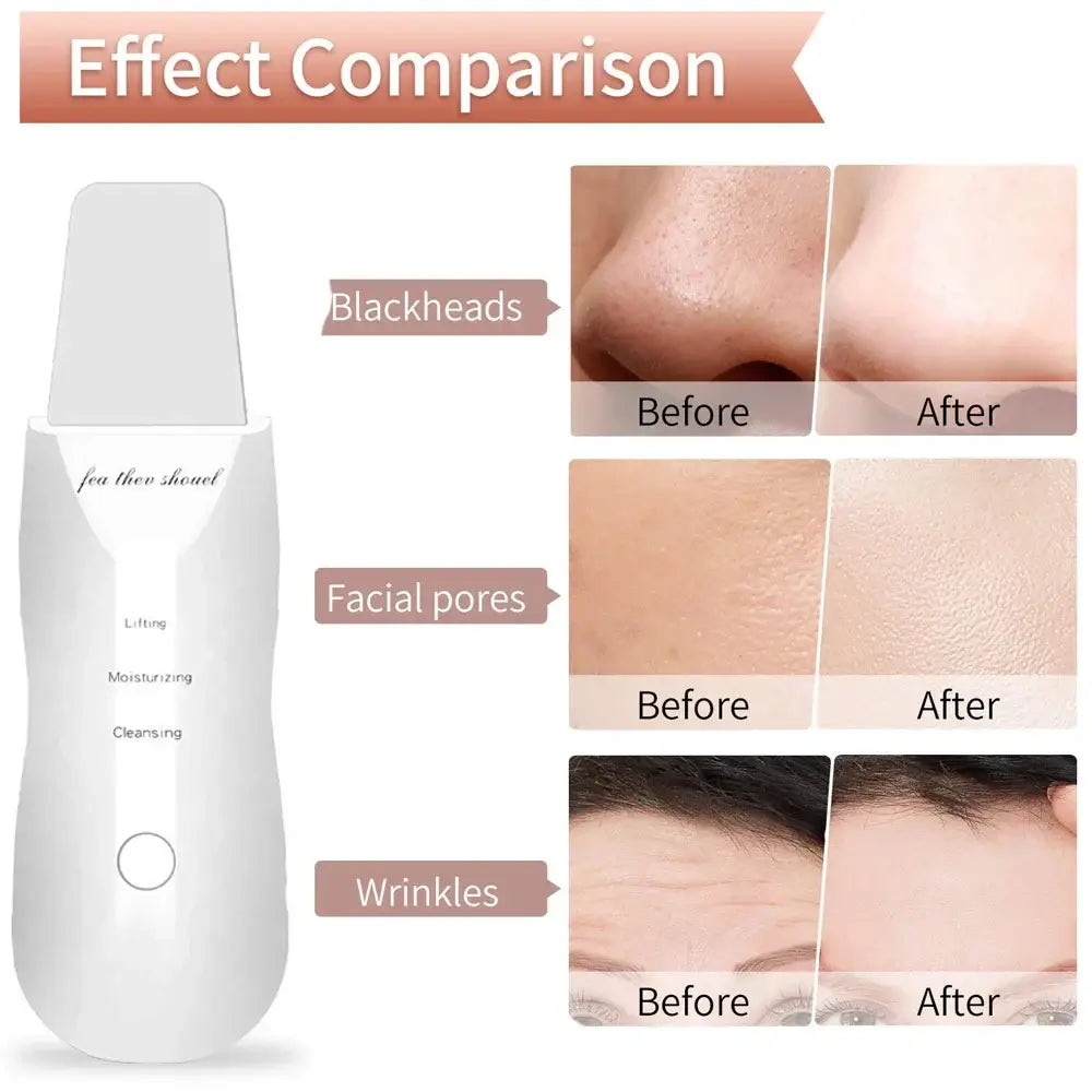 Facial Cleansing Brush – Deep Pore Cleanser with Massage Function for Blackhead Removal, Ideal Valentine’s Day Gift