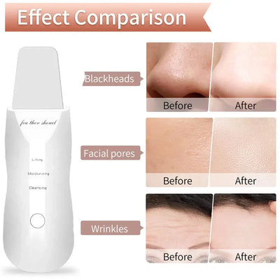 Facial Cleansing Brush – Deep Pore Cleanser with Massage Function for Blackhead Removal, Ideal Valentine’s Day Gift