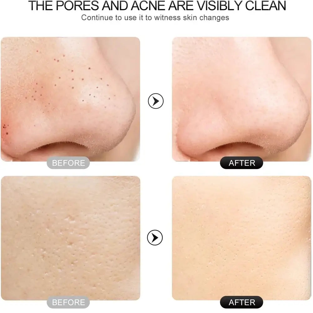 Facial Cleansing Brush – Deep Pore Cleanser with Massage Function for Blackhead Removal, Ideal Valentine’s Day Gift