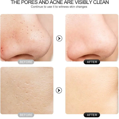 Facial Cleansing Brush – Deep Pore Cleanser with Massage Function for Blackhead Removal, Ideal Valentine’s Day Gift